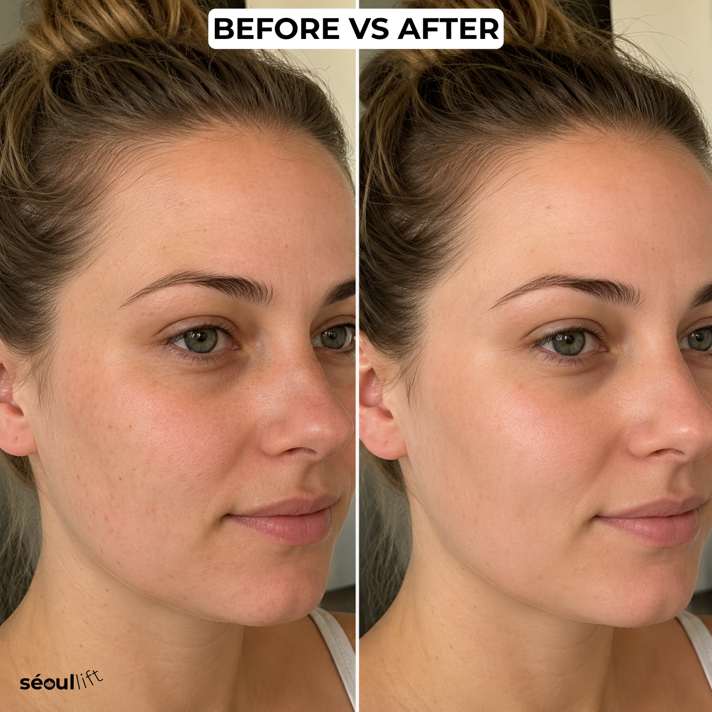 Volufiline 92% Plumping Serum (30ml)